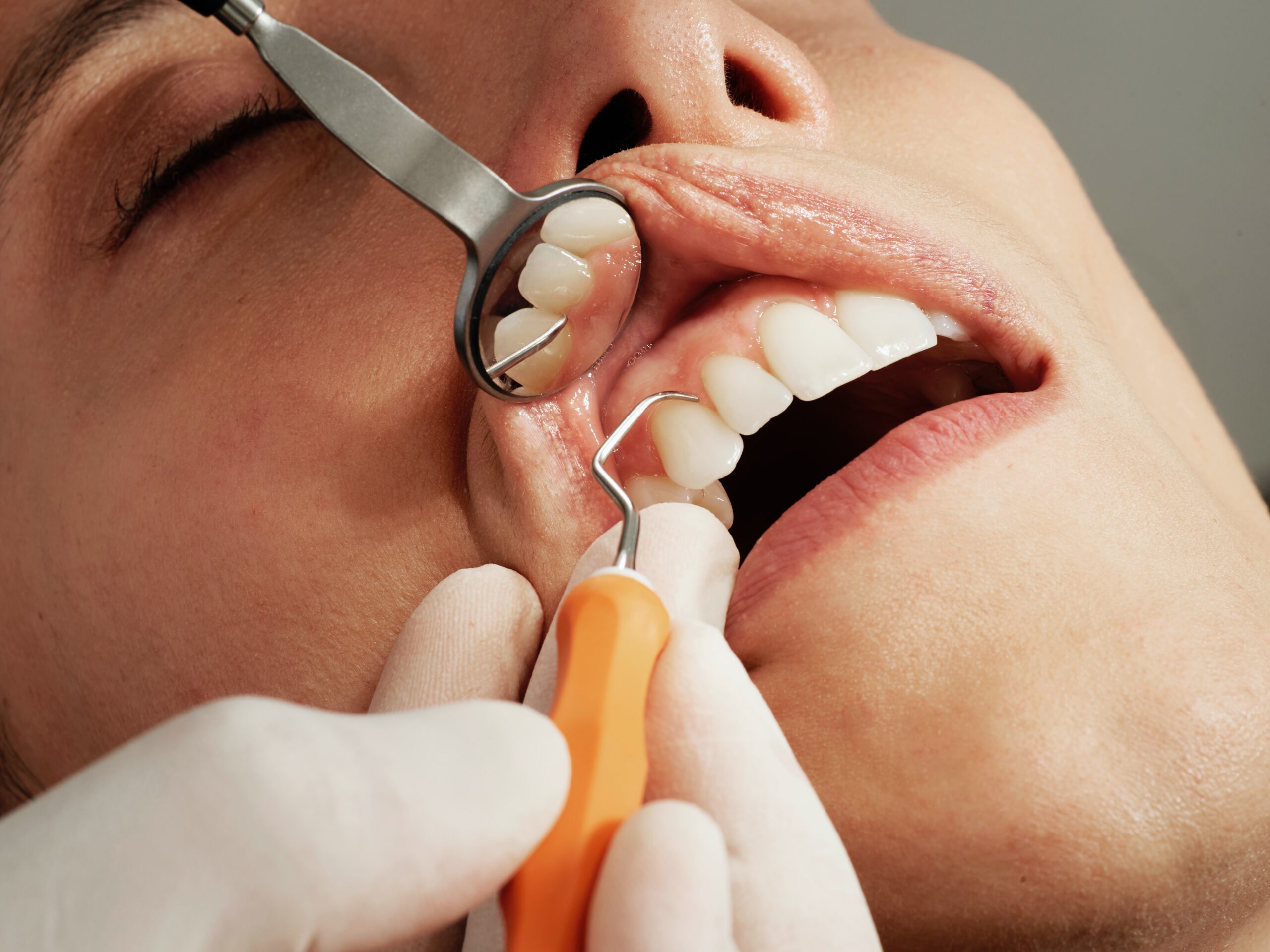 Dentysta przed wyrwanie zęba ogląda zęby pacjenta